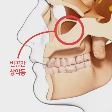 상악동의 위치 구조